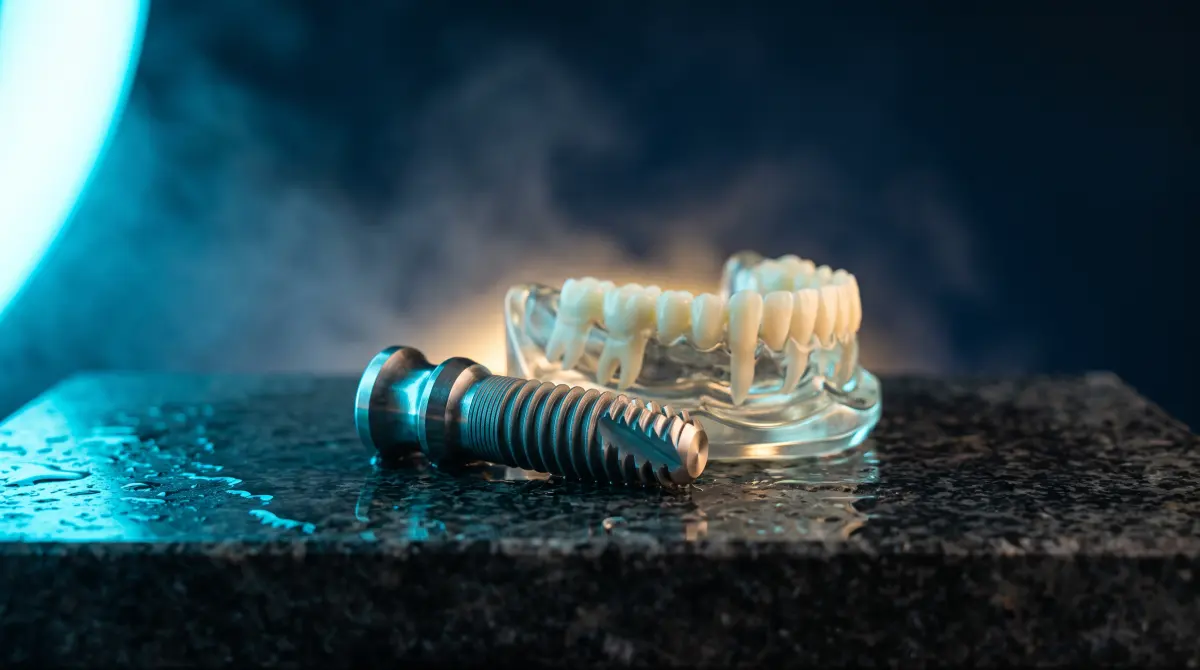 What Getting a Dental Implant Is Actually Like